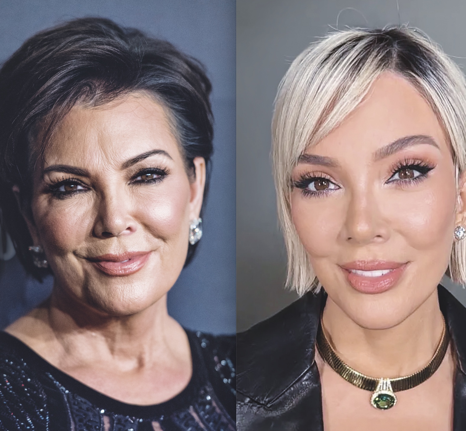 ¿Qué es el Deep Plane? La cirugía que todos quieren... pero sólo se pueden pagar las Kardashian